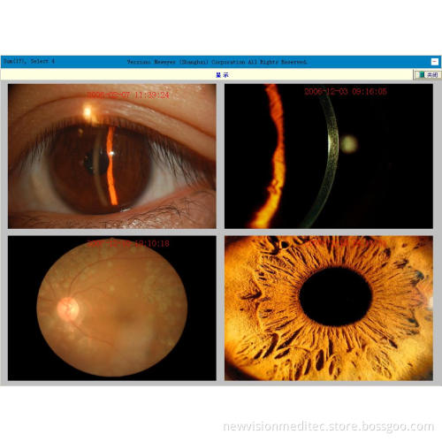 Digital Imaging System for Fundus Camera, Slit Lamp and Operating Microscope